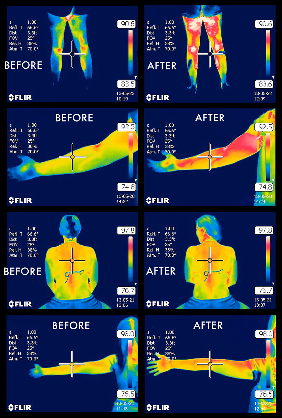 flir kepek